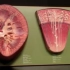 肾脏解剖结构 kidney anatomy