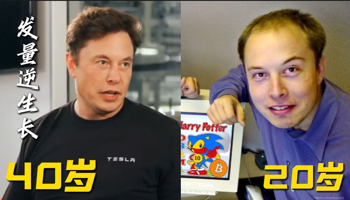 世界首富的生发秘笈！！内调才是yyds！