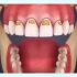 损伤了牙釉质该怎么修复呢？一起来看看吧「大连齿医生口腔修复中心」「大连口腔医院」