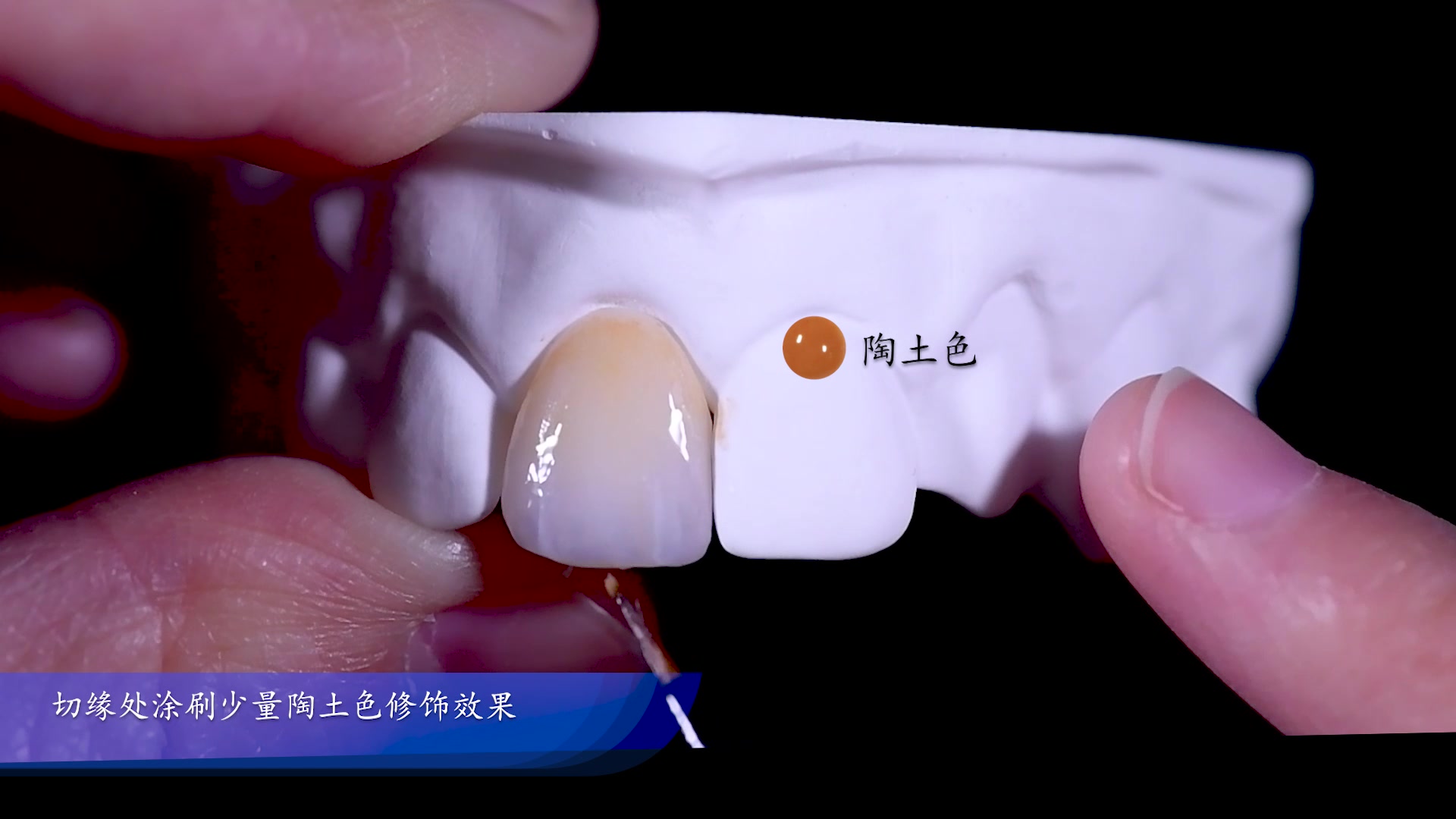 X-CERA 3D White 氧化锆 瓷块 - 氧化锆义齿 - 深圳翔通医疗科技有限公司