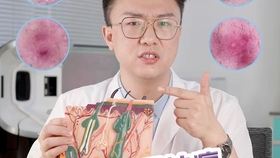 如何刷酸详细步骤 5b8563d8a7e23c8853391b67e6eb44ba65f6ee1f.jpg@280w_158h_1c_100q.jpg