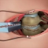 颈椎病的终极治疗，颈椎人工椎间盘置换手术过程，3D演示。。