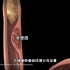 食管癌的发生原因，怎么治疗和预防，3D演示。。
