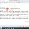 健康评估本科教学——常见症状   水肿