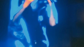 5d17e248de8a43fb7f7e40aac9e07bfe72504f31.jpg@280w_158h_1c_100q.jpg