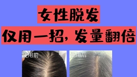 如何减肥不掉头发还有效 5fd1742b37f4a7762c3170f12f838af8bb50b4ef.jpg@280w_158h_1c_100q.jpg