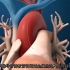 冠脉造影血管成形术动画演示