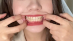 完美牙齿