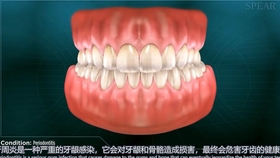 63f43b22917e416e2a960cfa28491444f5df2a82.jpg@280w_158h_1c_100q.jpg
