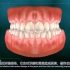 【中文字幕】一个人类得了牙周炎，这是他牙龈发生的不可逆的变化