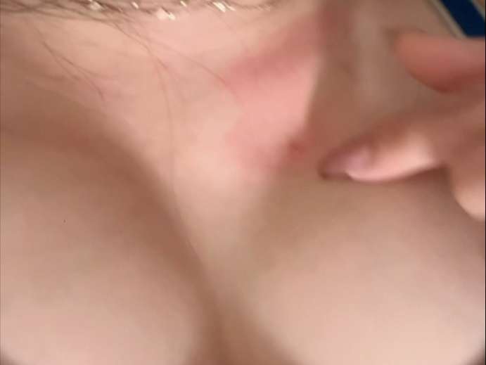 为什么每次都是这个地方长痘？