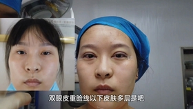 几个月可以分辨出是男还是女 64fad24d0cccdc3d2aa0a358056d396351ebae61.jpg@280w_158h_1c_100q.jpg