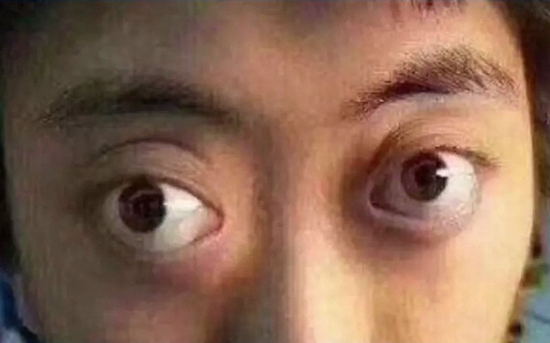 麻衣相法：金鱼眼有哪些特征？什么样的眼睛是金鱼眼？