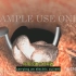【3D医学动画】经尿道前列腺电切术（中英双字幕+原版英文）