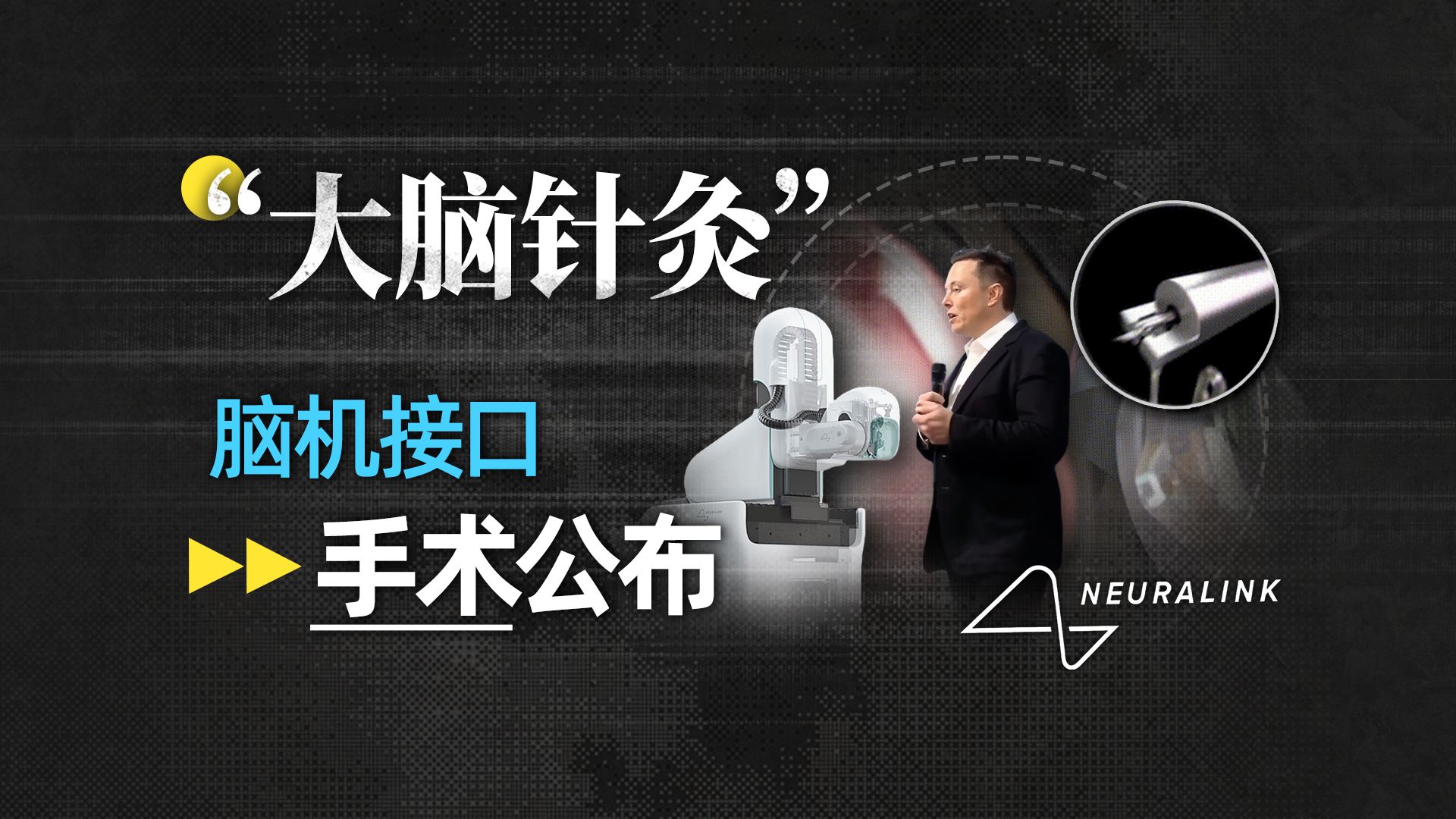 【氪大事】1.5秒一次，128针，Neuralink手术全流程公布