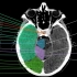 2.颅脑CT解剖图谱-颅脑CT解剖