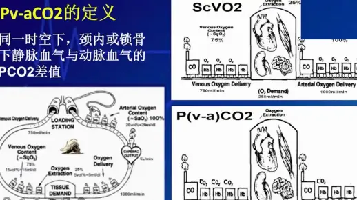 3.静动脉二氧化碳分压差——重症指标快速掌握