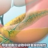 医学动画 - 胰腺的双重作用