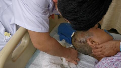 阑尾炎是怎么做微创手术的 69efb9dbc7cf96f25c6817a7c08bc6bd7b494246.jpg@480w_270h_1c