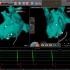 心房颤动-应用pentary+vizigo+ST行左房建模及肺静脉定口二尖瓣定口