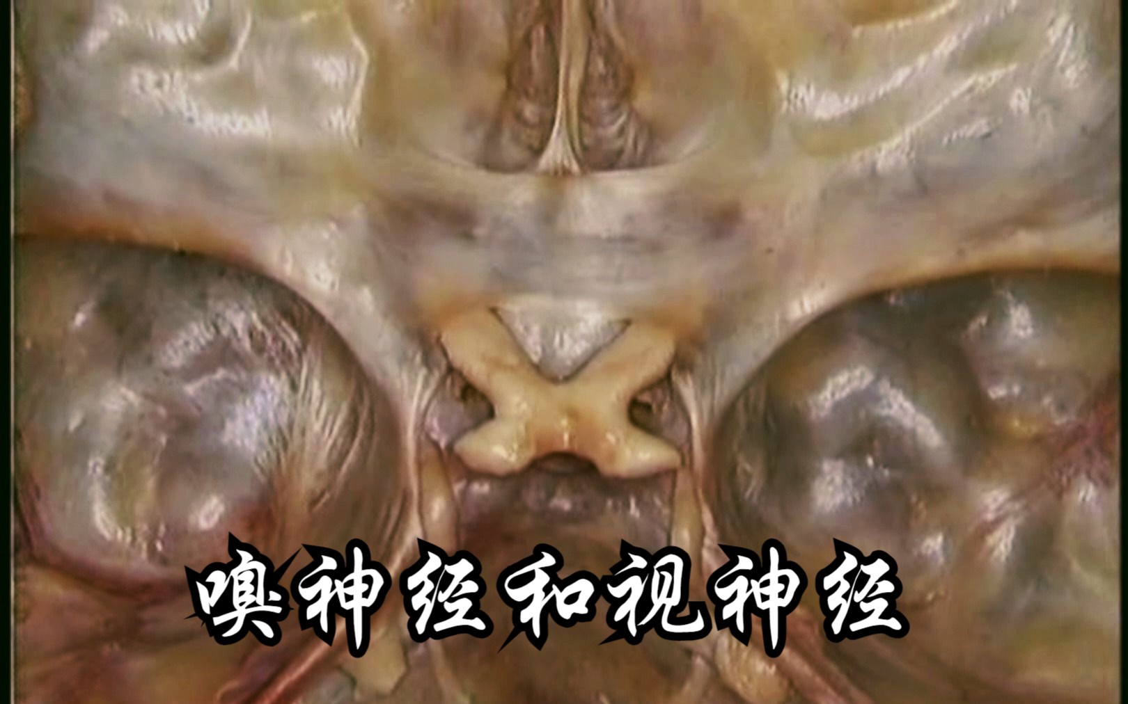 脑神经：嗅神经和视神经