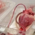 这个是 TransMedics 公司开发的器官维护系统的便携式设备，可以给从人体摘除的心脏提供氧气和血液，让心脏在器官运