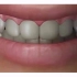 一口整齐的牙齿，让你同时获得美丽、健康与自信不好吗？「大连齿医生口腔修复中心」「大连口腔医院」