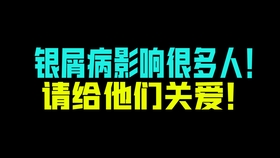 6cb8efd782c65a15847262e4b93b5595efa81cb1.jpg@280w_158h_1c_100q.jpg