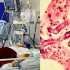 印度新冠确诊病例超千万例！康复者体内现罕见真菌，正在全印蔓延