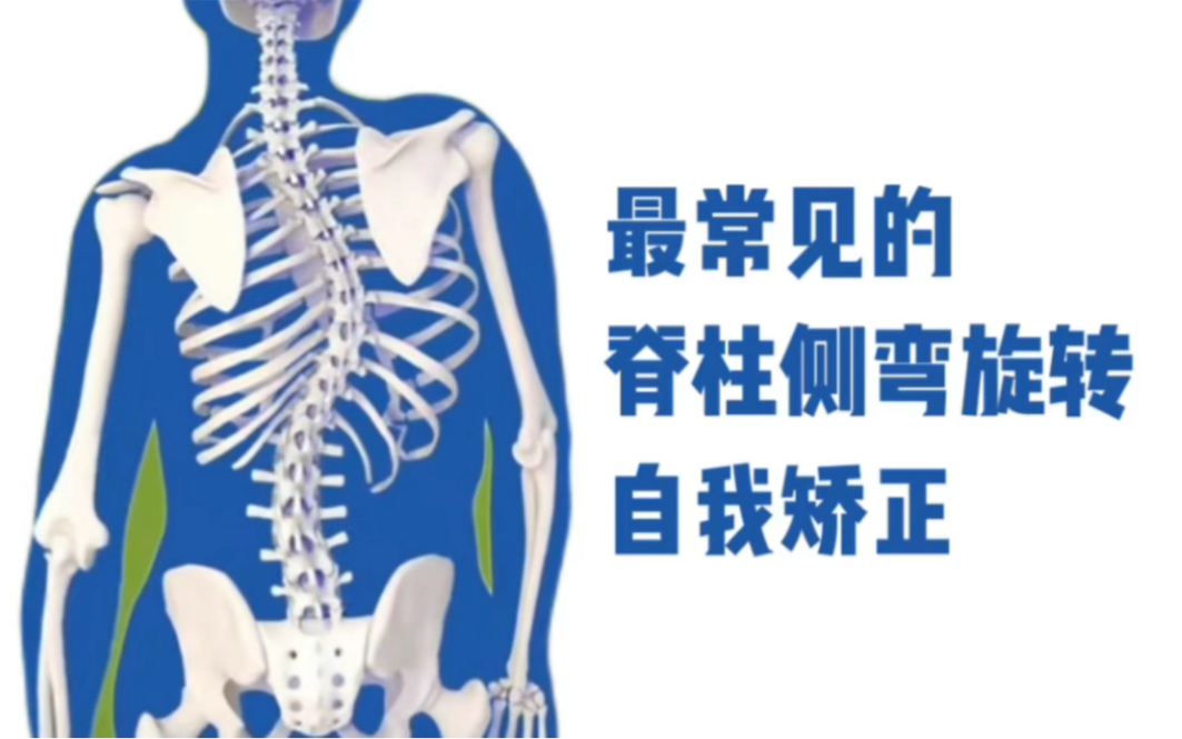 最常见的右侧臀部受力，右侧惯用手产生的脊柱旋转侧弯的自我矫正