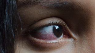 中药怎么洗眼睛 6e39c1a9730210a7a9f93a3ec04b6cc11d9030f1.jpg@310w_174h_1c_100q.jpg