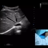 教学视频 | 腹部超声基本操作手法演示教程
