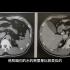 影像解剖讲解：正常胆囊、胰腺在CT上什么表现？放射科医生分享