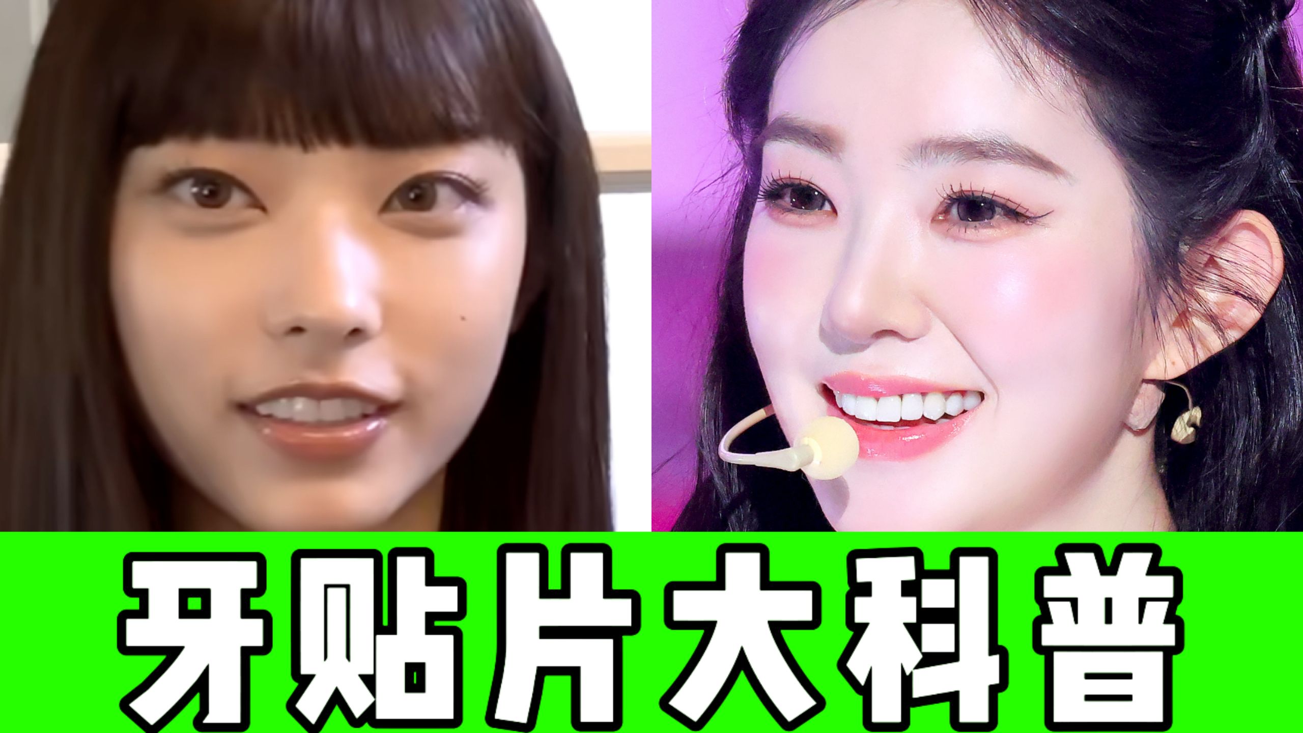 为什么韩国爱豆的牙贴片总是这么假，堪比毁容