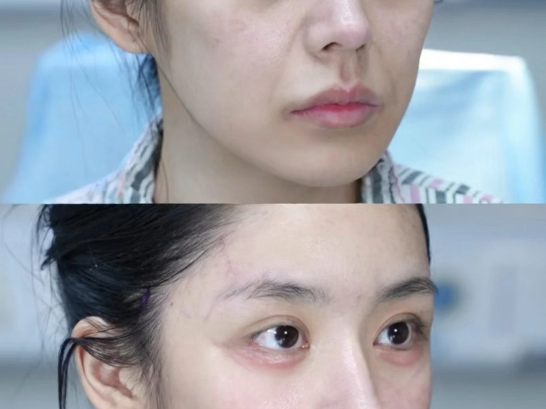 听点dj顺便变美：皮贴骨 筋膜提升 皮肤紧致 面部提拉 防面部下垂 保持面部轻盈感