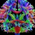 西门子MRI Terra 脑神经重建