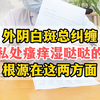 外阴白斑反复有症状！多数女性朋友有这两种情况