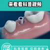 种植牙全过程你知道多少？来看看科普视频