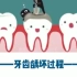 龋齿的发生发展至少需要半年以上，在龋齿早期的阶段进行干预，不仅治疗效果更好，还能有效预防牙髓炎哦【大洞不补，小洞吃苦呀】