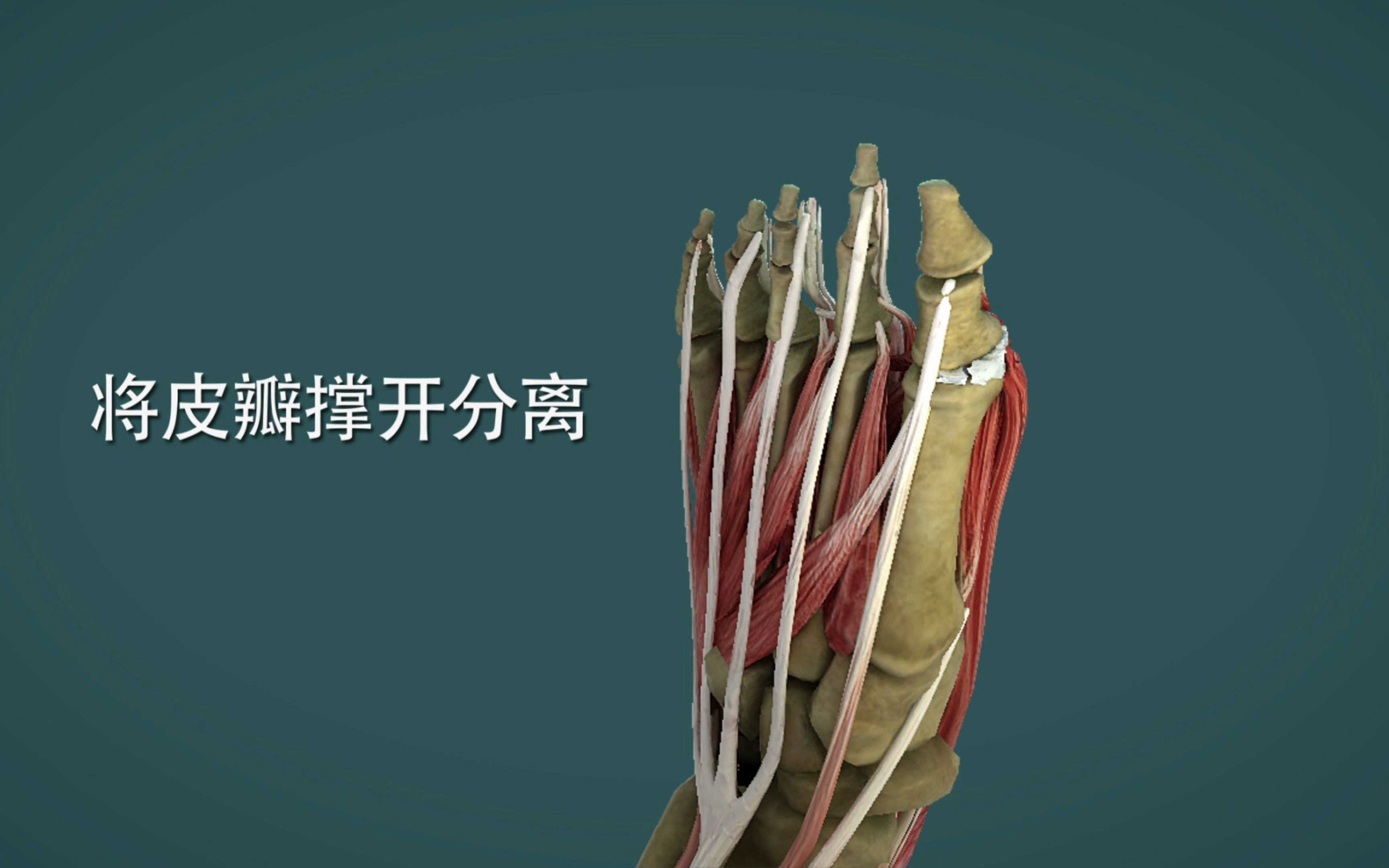 3D医学视频：痛风取石手术，看着都疼