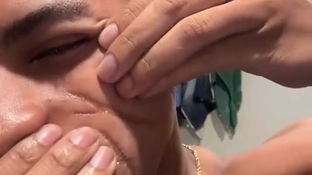 电影里的疤痕 是怎么来的