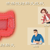 溃疡性结肠炎1：能拉到你脱水的结肠炎
