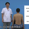 第2站体格检查-经典版-05脊柱、四肢及肛门检查 - Bilibili