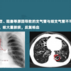 内科学呼吸系统高频考点（四）——支气管扩张