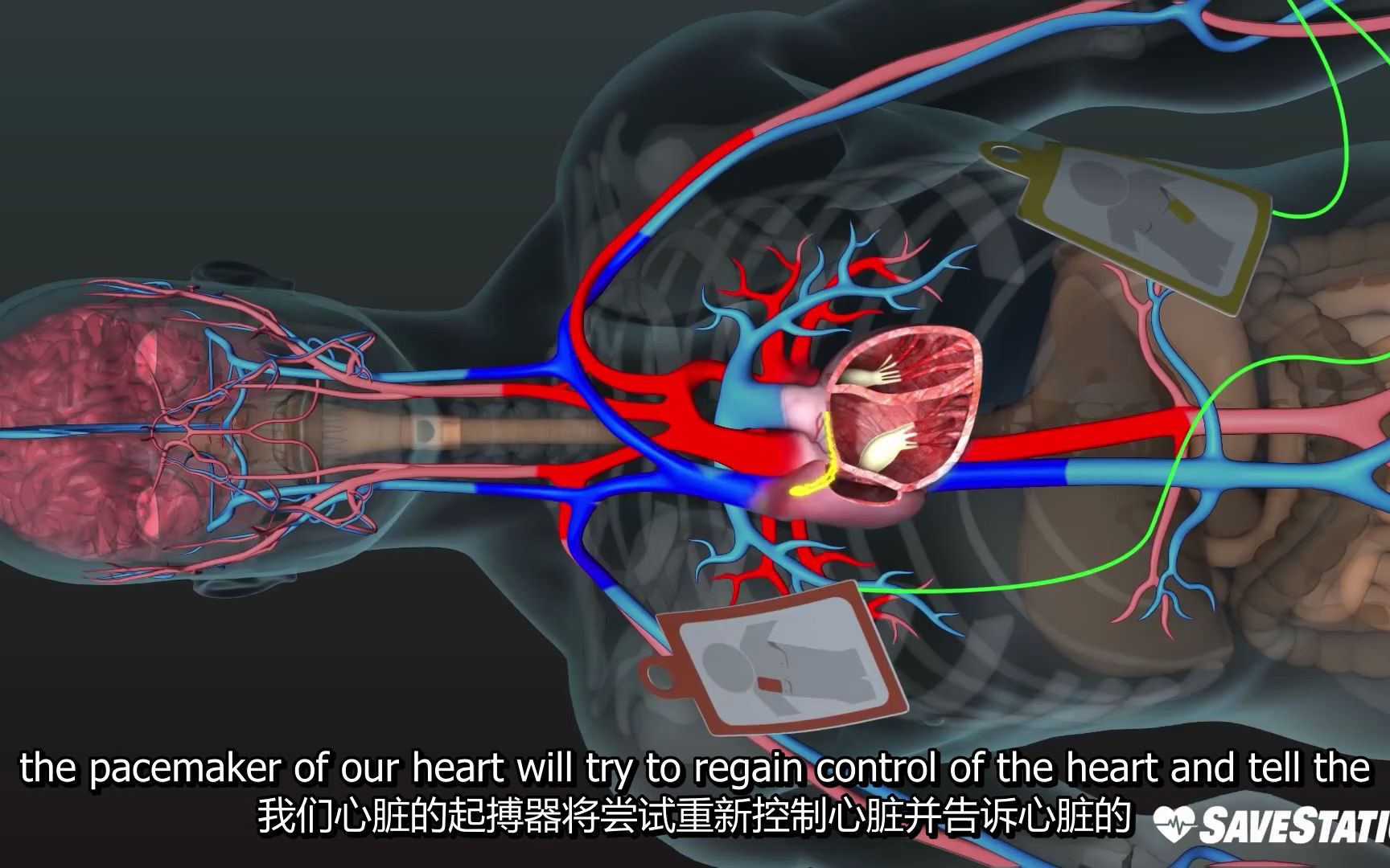 aed-aed-in-action-a-3d-look-inside-the-body-bilibili