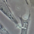 显微镜下成纤维细胞的运动接触抑制
