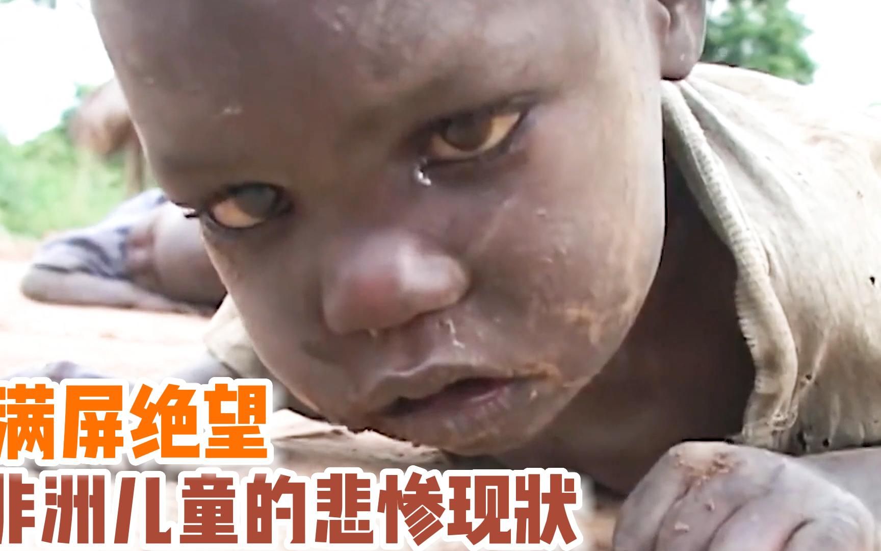 News dall'Africa: Allarme Unicef. 1,4 milioni di bambini a rischio ...