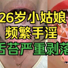 26岁小姑娘频繁手淫，舌苔严重剥落，大夫都惊呆了