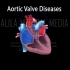 【Alila Medical Media】11. 主动脉瓣疾病，动画