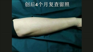 81cb95499c2d45c446838f6a210773a464c45373.jpg@310w_174h_1c_100q.jpg